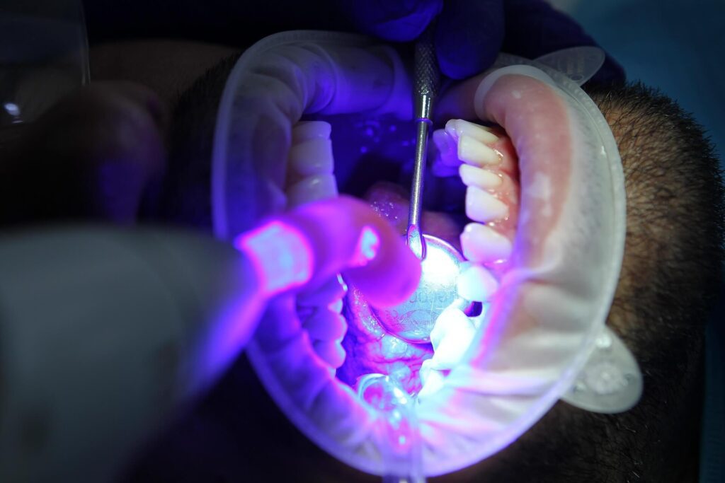 diegotoralabad-dentist-7397734_1920 (1)